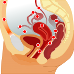 Endo and Infertility